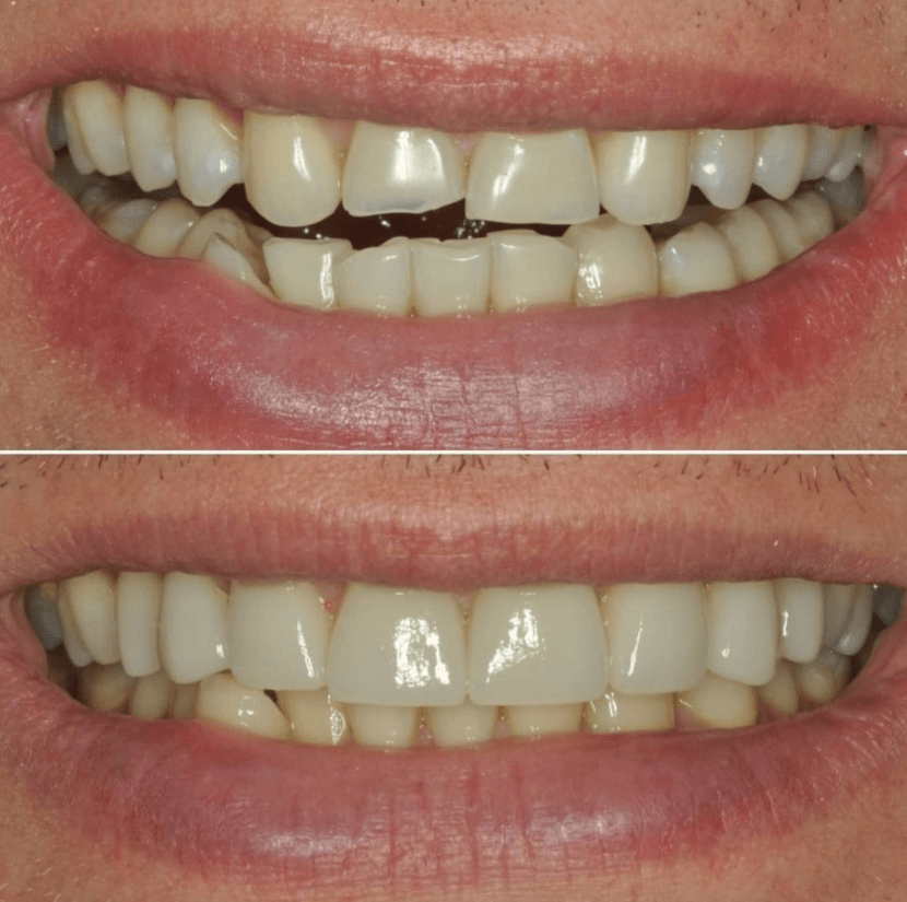 Before & After Photo