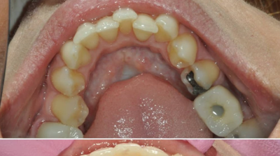 Before & After Photo