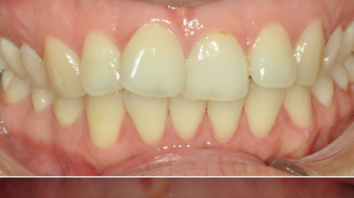 Before & After Photo
