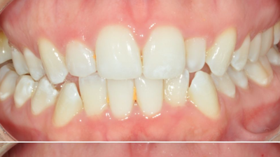 Before & After Photo