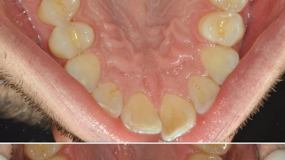 Before & After Photo