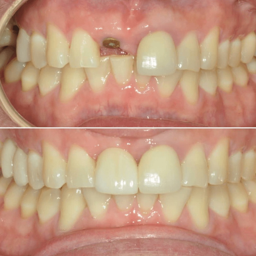 Before & After Photo