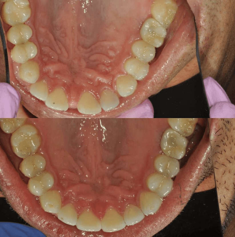 Before & After Photo