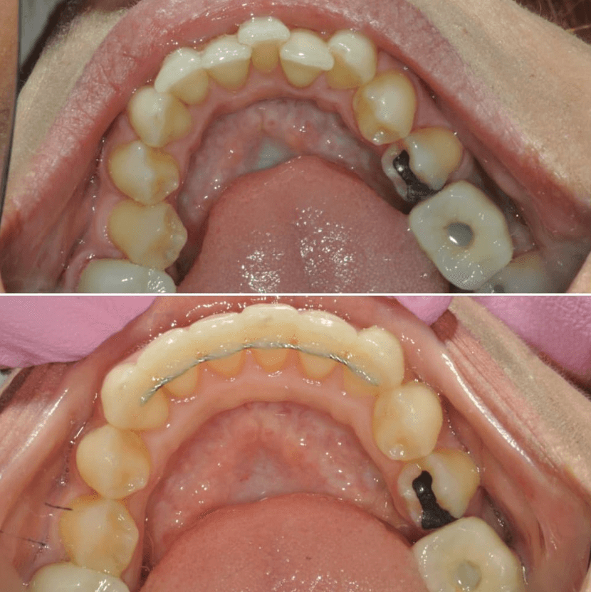 Before & After Photo