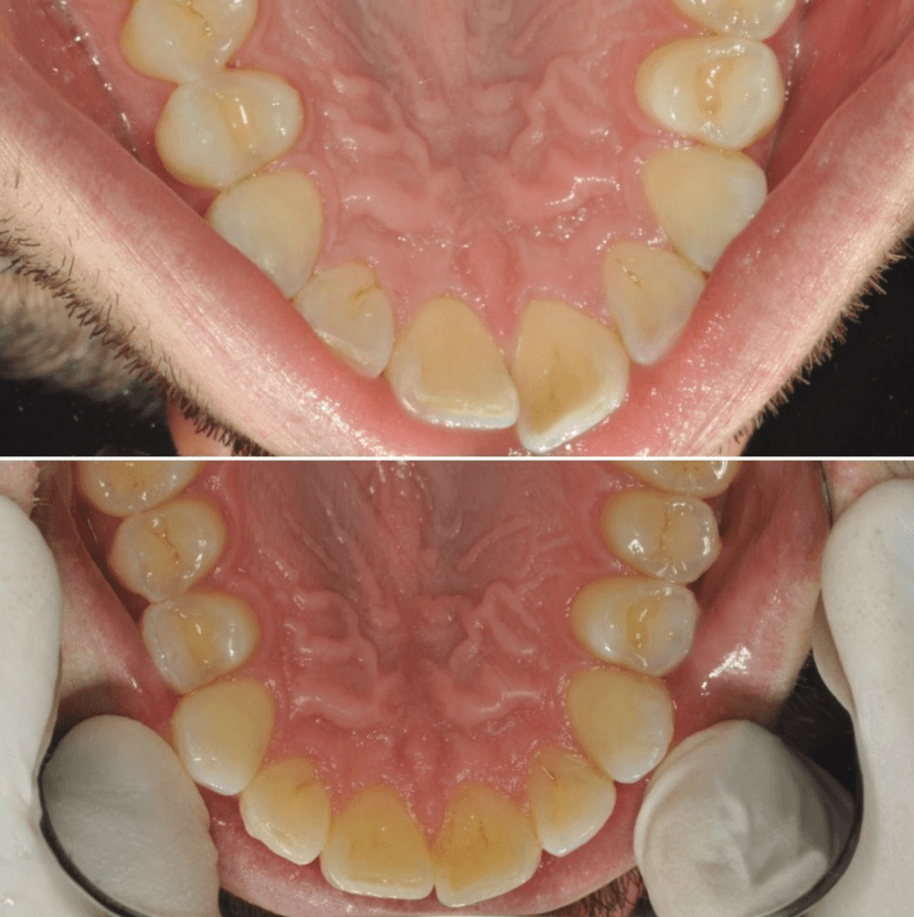 Before & After Photo