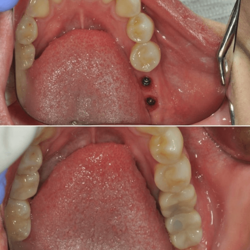 Before & After Photo