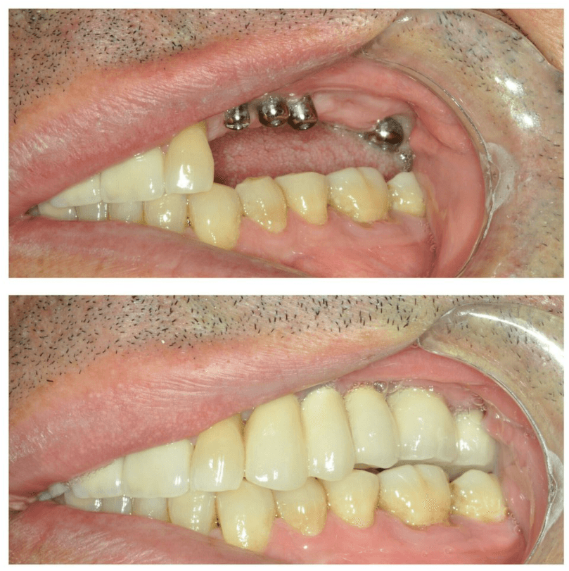 Before & After Photo