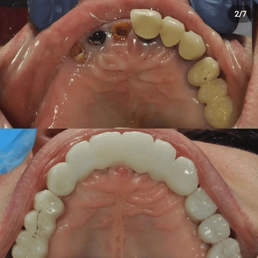 Before & After Photo