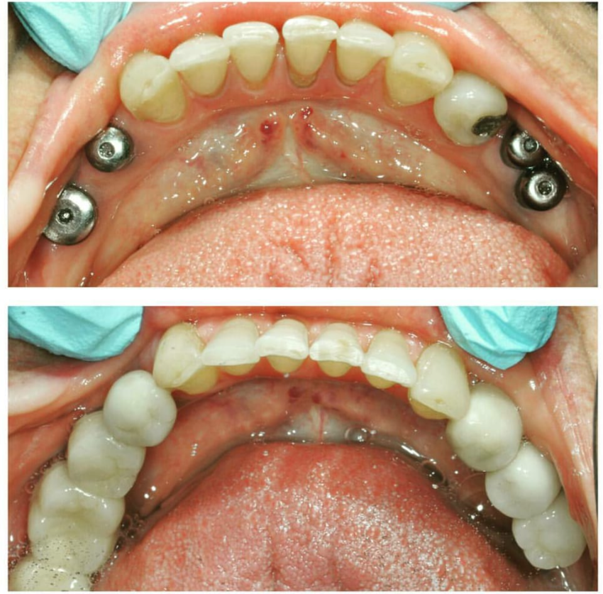 Before & After Photo