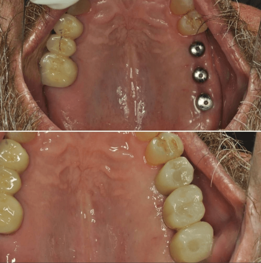 Before & After Photo