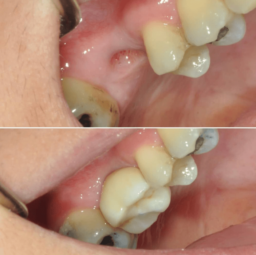 Before & After Photo