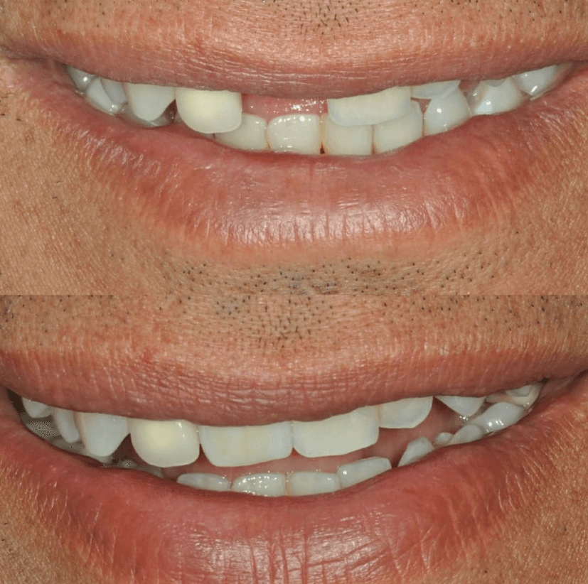 Before & After Photo