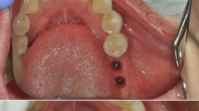 Before & After Photo