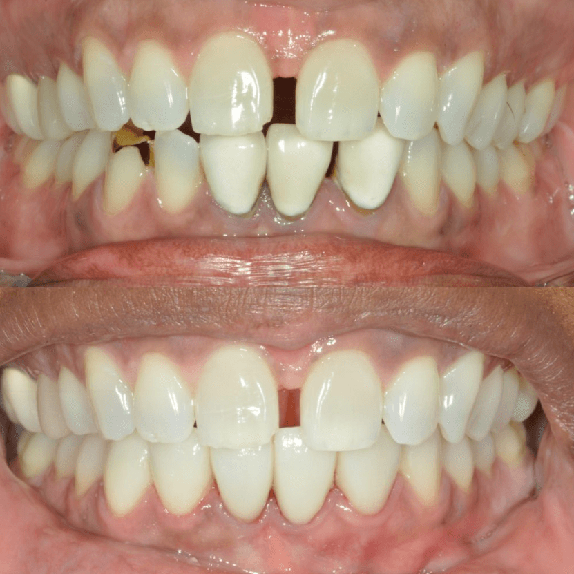 Before & After Photo